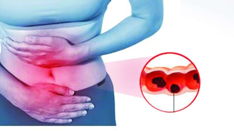 Abdominal Tuberculosis TB